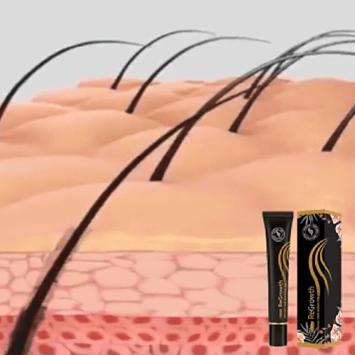 Sérum fortifiant cheveux – Traitement chute capillaire – 1 pièce
