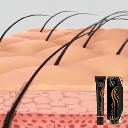 Sérum fortifiant cheveux – Traitement chute capillaire – 1 pièce